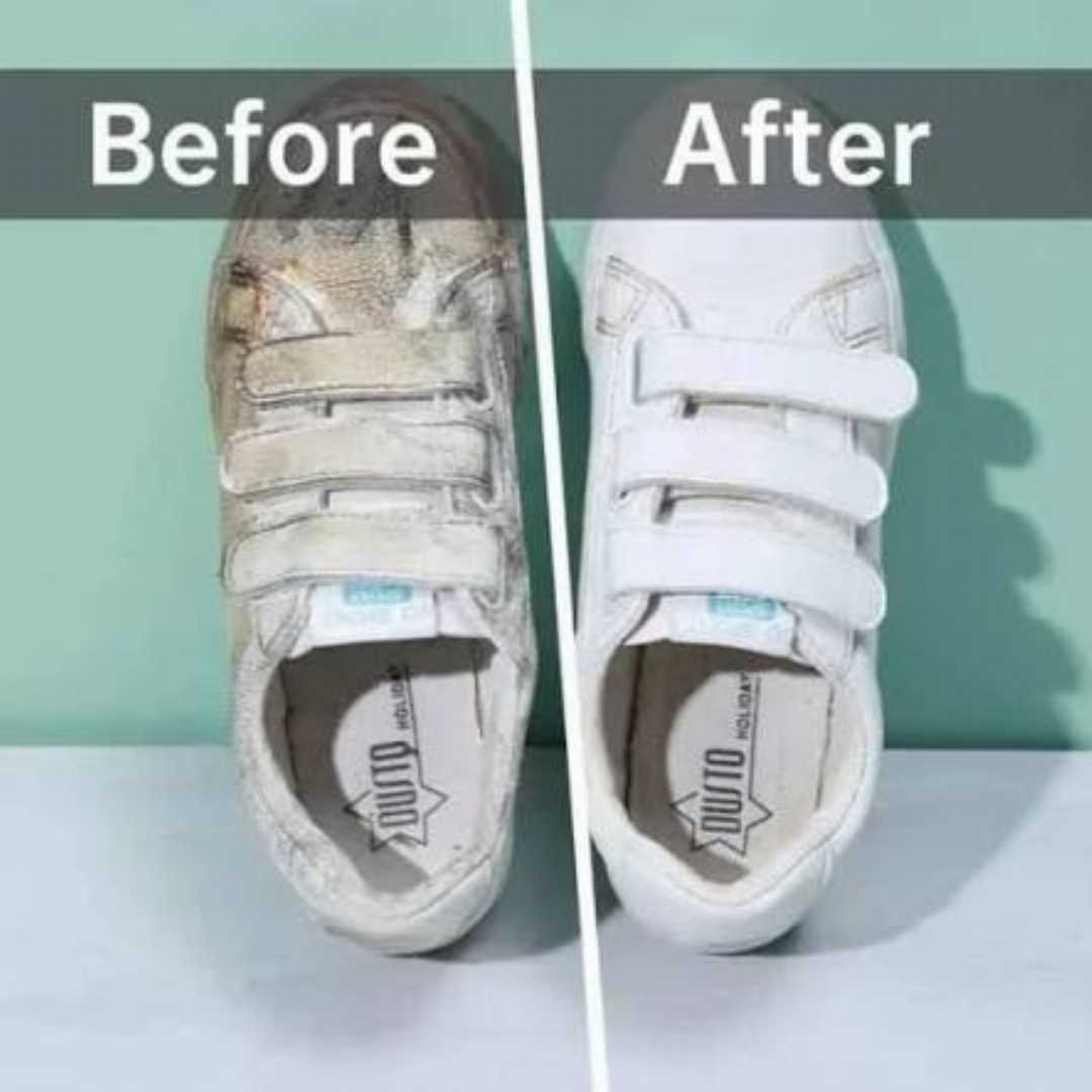 Disposable,Shoe,Cleaning,Wet,Wipes